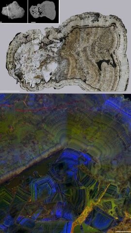 Thin Section of a Kidney Stone